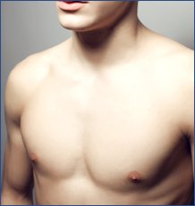 Gynecomastia in Birmingham, AL